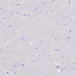 Invitrogen GPR182 Polyclonal Antibody 100 &mu;L | Buy Online | Invitrogen&trade; | Fisher Scientific