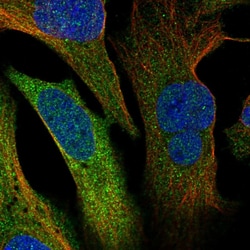Invitrogen Mig-6 Polyclonal Antibody 100 &mu;L; Unconjugated:Antibodies,