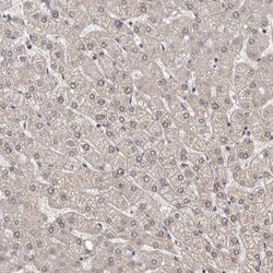 Invitrogen NIK Polyclonal Antibody 100 &mu;L; Unconjugated:Antibodies,
