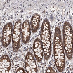 Invitrogen NIK Polyclonal Antibody 100 &mu;L; Unconjugated:Antibodies,