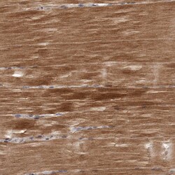 Invitrogen NIK Polyclonal Antibody 100 &mu;L; Unconjugated:Antibodies,