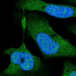 NIK Polyclonal Antibody, Invitrogen 100 &mu;L; Unconjugated:Antibodies,