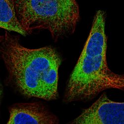 MOK Polyclonal Antibody, Invitrogen 100 &mu;L; Unconjugated:Antibodies,