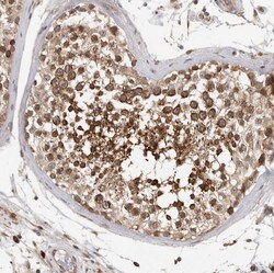 Invitrogen OXR1 Polyclonal Antibody 100 &mu;L; Unconjugated:Antibodies,
