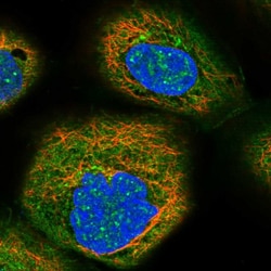 Invitrogen FAS Polyclonal Antibody 100 μL; Unconjugated:Antibodies,