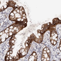 Invitrogen FAS Polyclonal Antibody 100 μL; Unconjugated:Antibodies,