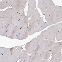 Invitrogen FAS Polyclonal Antibody 100 μL; Unconjugated:Antibodies,