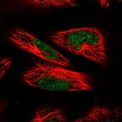 POLR3C Polyclonal Antibody:Antibodies, Polyclonal