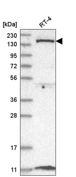 Invitrogen DGKD Polyclonal Antibody 100 &mu;L; Unconjugated:Antibodies,