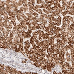 Invitrogen IL1R2 Polyclonal Antibody:Antibodies:Primary Antibodies