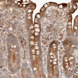 Invitrogen IL1R2 Polyclonal Antibody 100 &mu;L; Unconjugated:Antibodies,