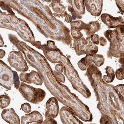Invitrogen IL1R2 Polyclonal Antibody 100 &mu;L; Unconjugated:Antibodies,