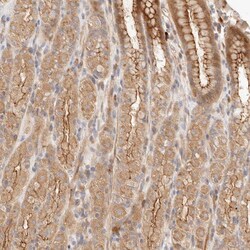 Invitrogen IL1R2 Polyclonal Antibody 100 &mu;L; Unconjugated:Antibodies,