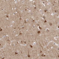 Invitrogen RANK Polyclonal Antibody:Antibodies:Primary Antibodies