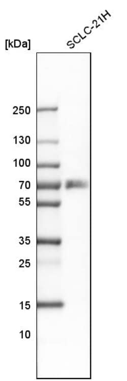 Invitrogen RANK Polyclonal Antibody 100 &mu;L; Unconjugated:Antibodies,