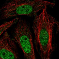 Invitrogen ZNF131 Polyclonal Antibody 100 &mu;L; Unconjugated:Antibodies,