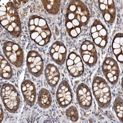 Invitrogen Bax Polyclonal Antibody 100 &mu;L | Buy Online | Invitrogen&trade; | Fisher Scientific