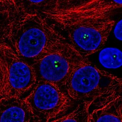 Invitrogen Coilin Polyclonal Antibody 100 μL; Unconjugated:Antibodies,