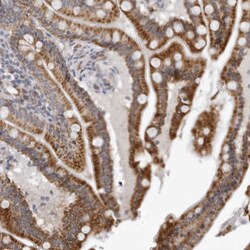 Invitrogen CPT2 Polyclonal Antibody 100 &mu;L; Unconjugated:Antibodies,