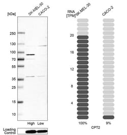 Invitrogen CPT2 Polyclonal Antibody:Antibodies:Primary Antibodies