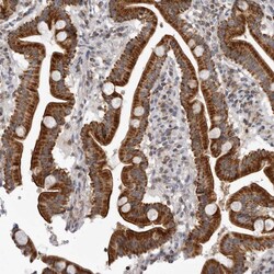Invitrogen CPT2 Polyclonal Antibody:Antibodies:Primary Antibodies