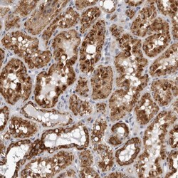 Invitrogen CPT2 Polyclonal Antibody:Antibodies:Primary Antibodies
