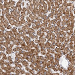 Invitrogen CPT2 Polyclonal Antibody:Antibodies:Primary Antibodies