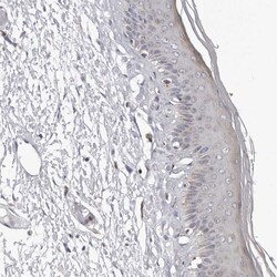 Invitrogen CPT2 Polyclonal Antibody:Antibodies:Primary Antibodies