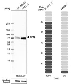 Invitrogen CPT2 Polyclonal Antibody:Antibodies:Primary Antibodies