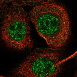 Invitrogen EXO5 Polyclonal Antibody 100 &mu;L; Unconjugated:Antibodies,