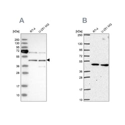 Invitrogen SLC25A24 Polyclonal Antibody 100 &mu;L | Buy Online | Invitrogen&trade; | Fisher Scientific