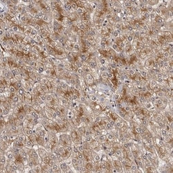 Invitrogen ALS2CR2 Polyclonal Antibody:Antibodies:Primary Antibodies