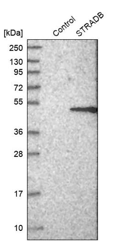 Invitrogen ALS2CR2 Polyclonal Antibody 100 &mu;L; Unconjugated:Antibodies,