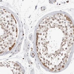 Invitrogen HSP105 Polyclonal Antibody 100 &mu;L; Unconjugated:Antibodies,