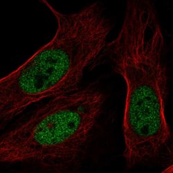 BAP1 Polyclonal Antibody, Invitrogen 100 &mu;L; Unconjugated:Antibodies,