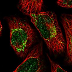 Invitrogen ALDH6A1 Polyclonal Antibody 100 &mu;L; Unconjugated:Antibodies,