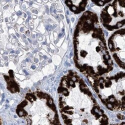 Invitrogen ALDH6A1 Polyclonal Antibody 100 &mu;L; Unconjugated:Antibodies,