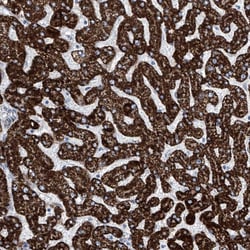 Invitrogen ALDH6A1 Polyclonal Antibody 100 &mu;L; Unconjugated:Antibodies,