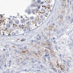 Invitrogen ALDH6A1 Polyclonal Antibody 100 &mu;L; Unconjugated:Antibodies,
