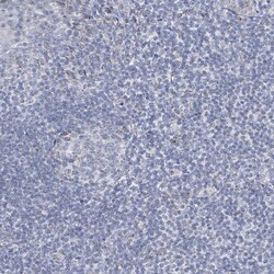 Invitrogen ALDH6A1 Polyclonal Antibody 100 &mu;L; Unconjugated:Antibodies,