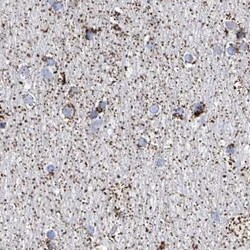 Invitrogen ALDH6A1 Polyclonal Antibody 100 &mu;L; Unconjugated:Antibodies,
