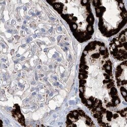 Invitrogen ALDH6A1 Polyclonal Antibody 100 &mu;L; Unconjugated:Antibodies,