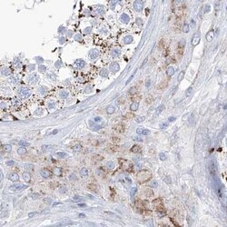Invitrogen ALDH6A1 Polyclonal Antibody 100 &mu;L; Unconjugated:Antibodies,