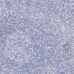 Invitrogen ALDH6A1 Polyclonal Antibody 100 &mu;L; Unconjugated:Antibodies,