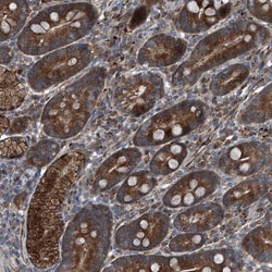Invitrogen SENP2 Polyclonal Antibody 100 μL; Unconjugated:Antibodies,