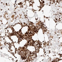 Invitrogen TRIM4 Polyclonal Antibody 100 μL; Unconjugated:Antibodies,
