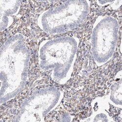 Invitrogen TGM2 Polyclonal Antibody 100 μL; Unconjugated:Antibodies,