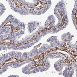 Invitrogen TGM2 Polyclonal Antibody 100 μL; Unconjugated:Antibodies,