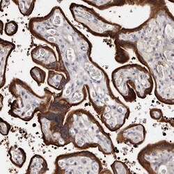 Invitrogen TGM2 Polyclonal Antibody 100 μL; Unconjugated:Antibodies,