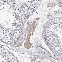 Invitrogen TGM2 Polyclonal Antibody 100 μL; Unconjugated:Antibodies,